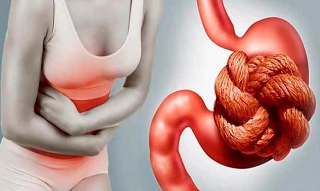 Constipation: warning signs